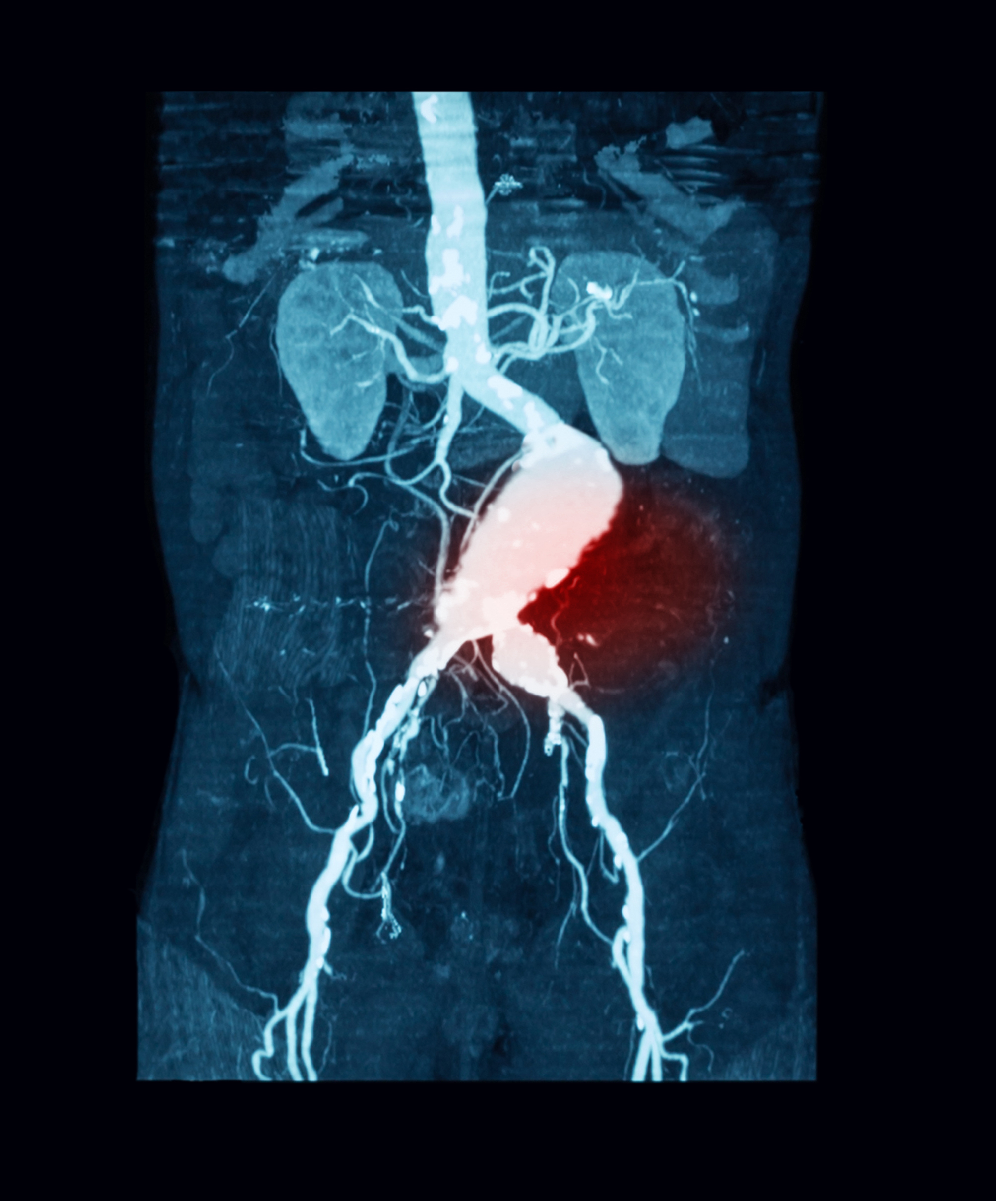 cardiovascular imaging