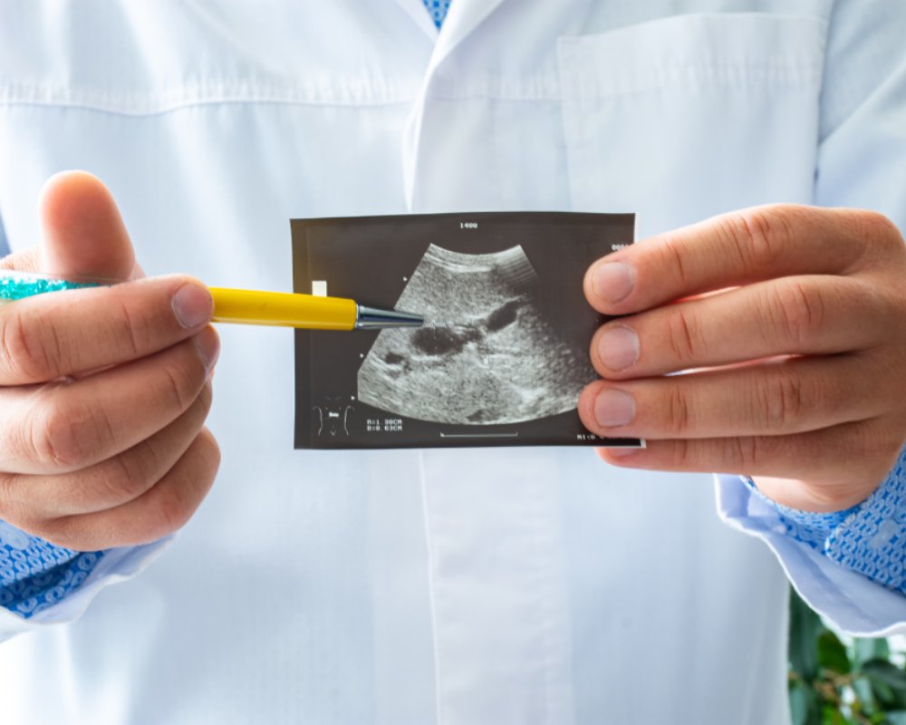 ultrasound for gallbladder