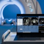 calcium-scan-on-screen